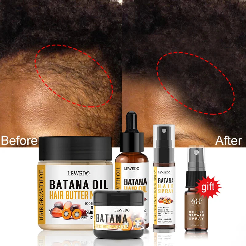 Fast Hair Growth Oil Africa Crazy Traction Alopecia batana Hair Mask Anti Hair Break Hair