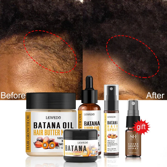 Fast Hair Growth Oil Africa Crazy Traction Alopecia batana Hair Mask Anti Hair Break Hair