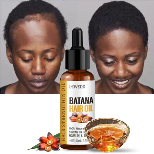Lewedo Naturals Batana Oil Fast Hair Growth for Men Women Pure Batana Oil Nourish Shiny