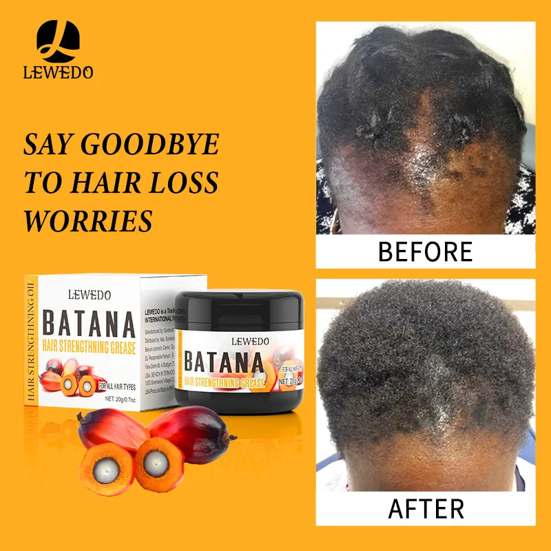 Fast Hair Growth Oil Africa Crazy Traction Alopecia batana Hair Mask Anti Hair Break Hair